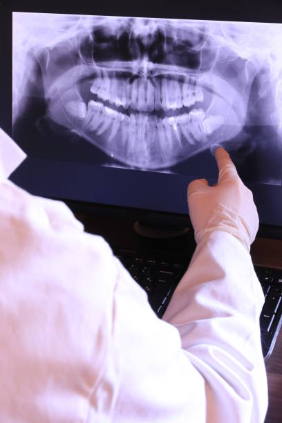 Best Emergency Treatment for Toothache in Broadmoor, CA