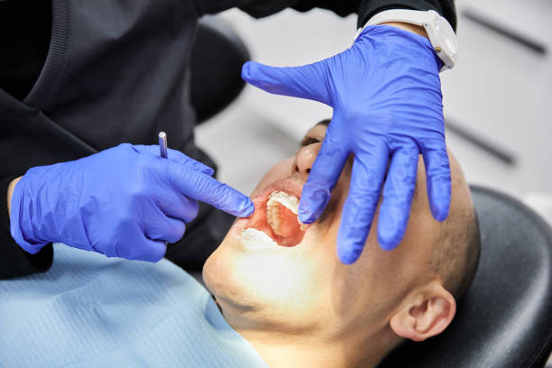 Best Emergency Wisdom Teeth Removal in Broadmoor, CA